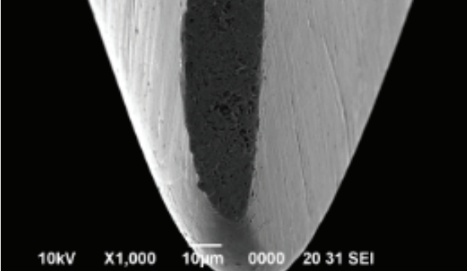 Figure 3 showing a surgical blade edge that ground unevenly making it dull.