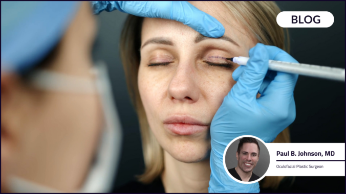 Upper blepharoplasty improves visual field and quality of life through millimeter-level precision, balancing tissue removal with ocular surface protection.