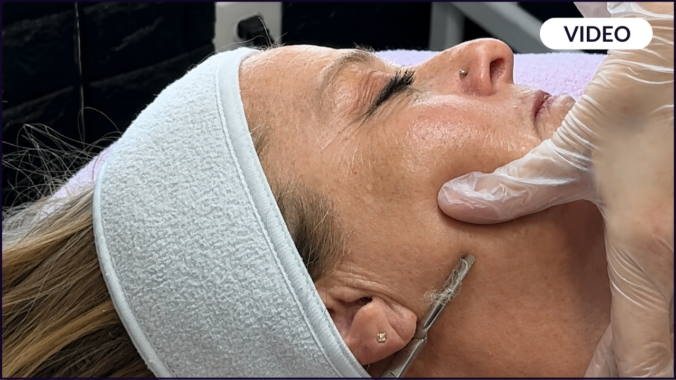 Dermaplaning Mature Skin